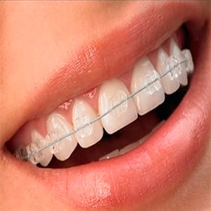 DENTISTA EM NAVEGANTES