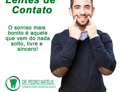 Colocação de Lentes de Contato Dentária